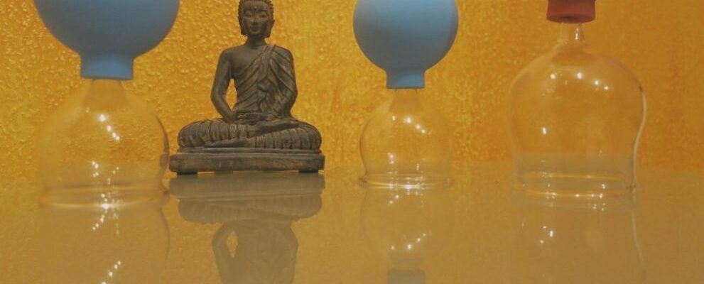 Gesundheitspraxis Oberfranken: Die Buddha Skulptur sitzt zwischen den Schröpfgläsern