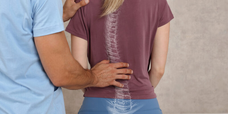 Scoliosis Spine Curve Anatomy, Posture Correction. Chiropractic treatment, Back pain relief.